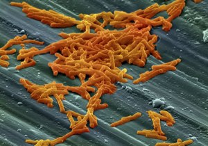 Clostridium difficile, hace honor a su nombre.