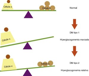 Balanzas tipos de diabetes